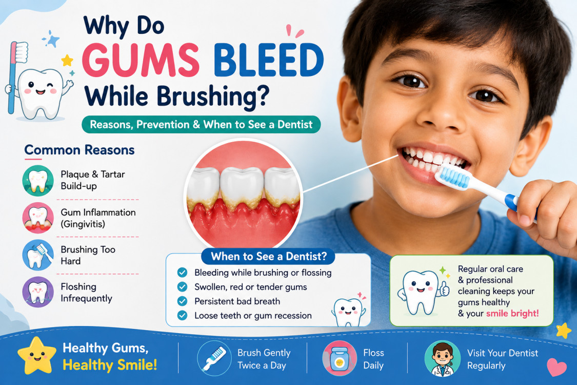 Why Do Gums Bleed While Brushing? Reasons, Prevention and Visit the Dentist