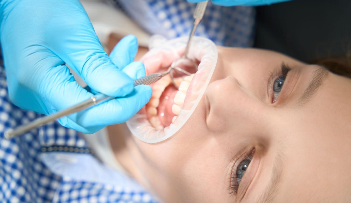 Your Complete Guide to Endodontics Dentistry