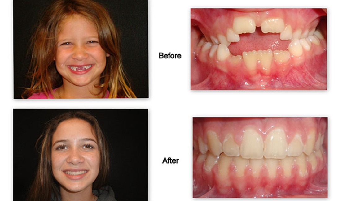 Complete Guide to Orthodontic Dentistry for a Healthy Smile